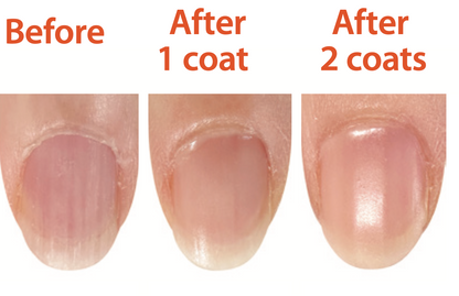 Mani Rehab: Ridge Filler